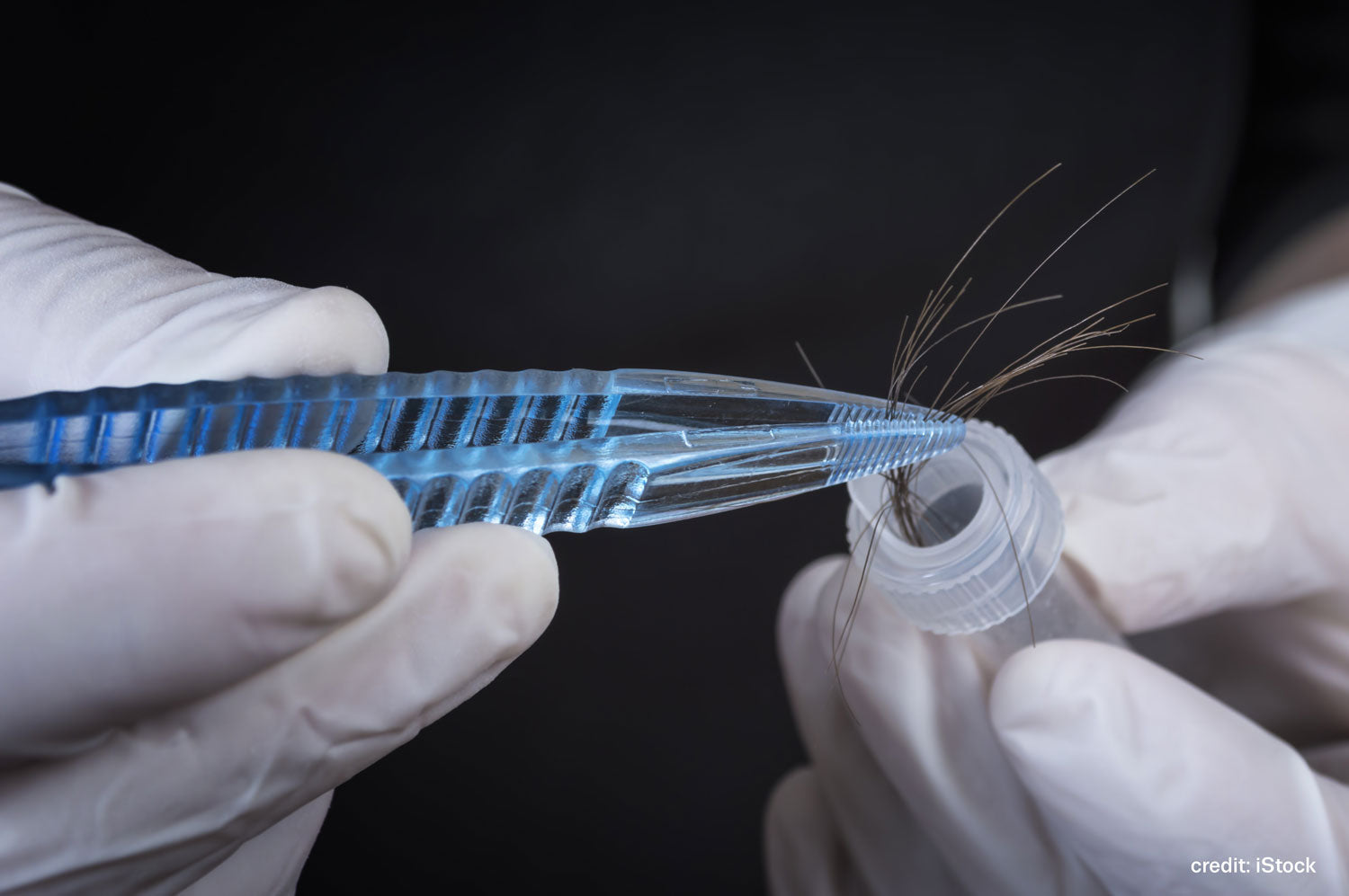 iStock-896226446-hair-strand-laboratory-1500px.jpg__PID:9acb8f8c-607f-43dc-95eb-23b45e6d8835